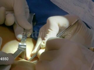 Aj sotavento desde wwe consigue su third pecho implant: gratis xxx presilla 8e